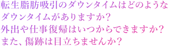 どのようなダウンタイムがありますか？
