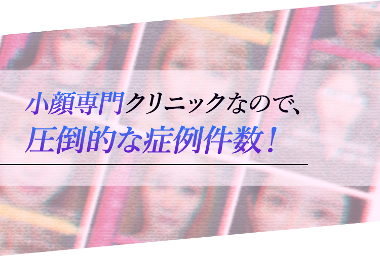 小顔専門クリニックなので、圧倒的な症例件数！